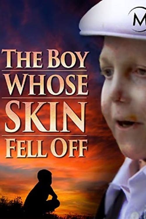 Caratula de THE BOY WHOSE SKIN FELL OFF